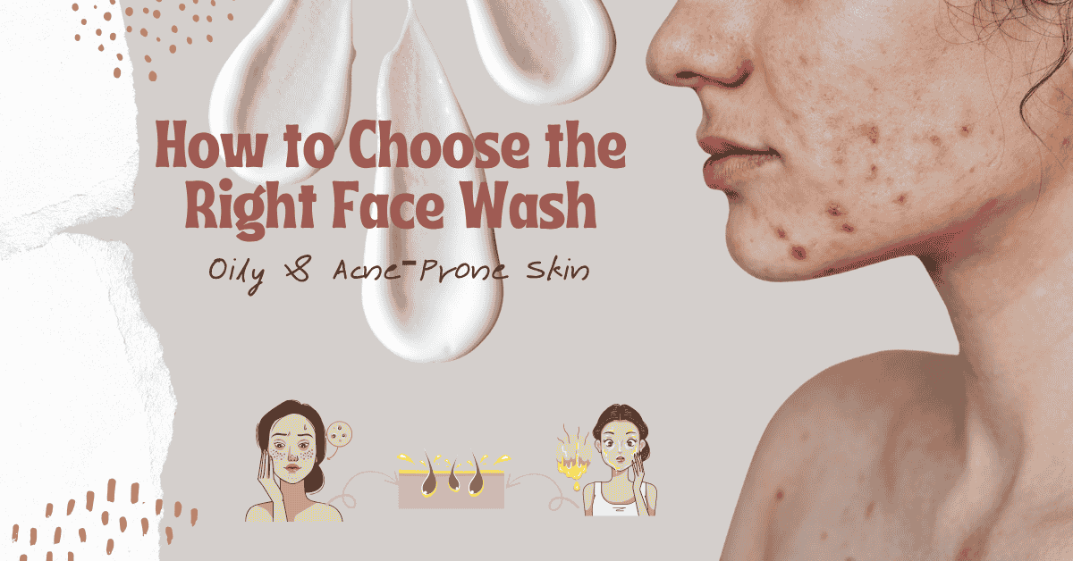 How to Choose the Right Face Wash for Oily &amp; Acne‑Prone Skin