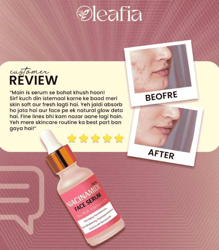 15% Niacinamide Face Serum
