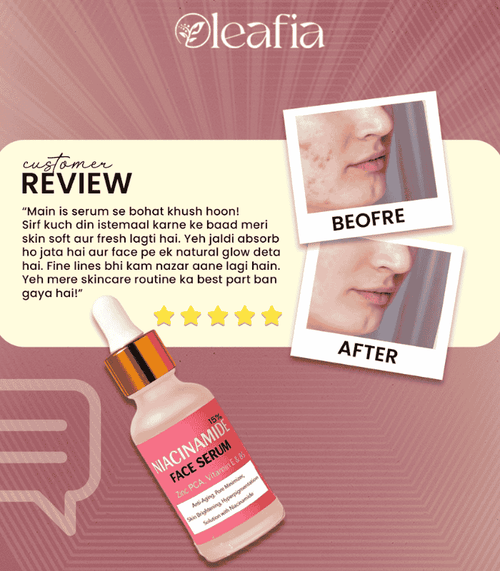 15% Niacinamide Face Serum