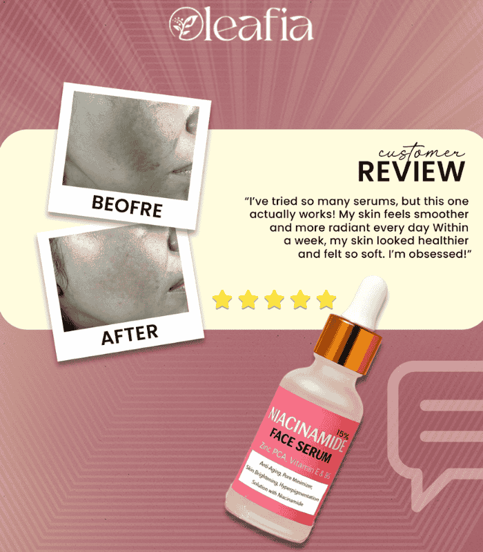 15% Niacinamide Face Serum